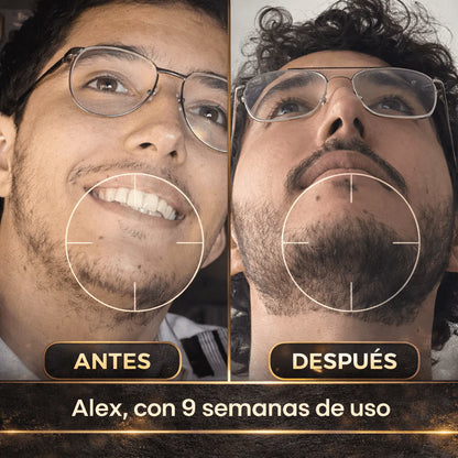 Estimulante de Barba Apolo Ultra Potente 100ml | Más Crecimiento y Densidad VIEJO VIEJO VIEJO